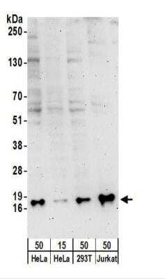 Western Blot: SNRPD3 Antibody [NBP2-22306]