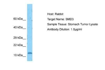 Western Blot: SNRPD3 Antibody [NBP2-88323]