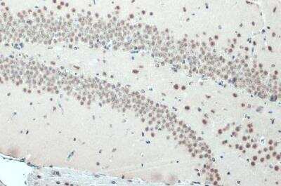 Immunohistochemistry-Paraffin: SNRPE Antibody [NBP2-43792]