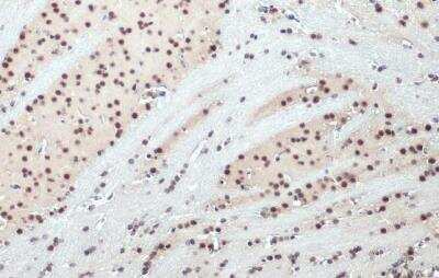 Immunohistochemistry-Paraffin: SNRPE Antibody [NBP2-43792]