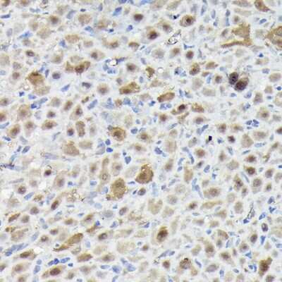 Immunohistochemistry-Paraffin: SNRPE Antibody - BSA Free [NBP2-94255]