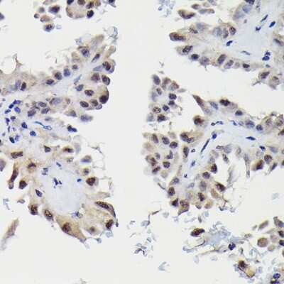 Immunohistochemistry-Paraffin: SNRPE Antibody - BSA Free [NBP2-94255]
