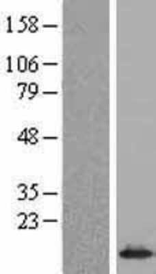 Western Blot: SNRPE Overexpression Lysate [NBL1-16292]