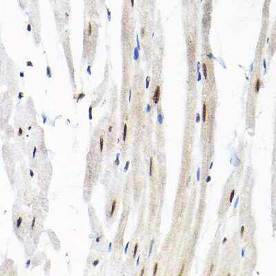 Immunohistochemistry-Paraffin: SNRPF Antibody - Azide and BSA Free [NBP2-93854]