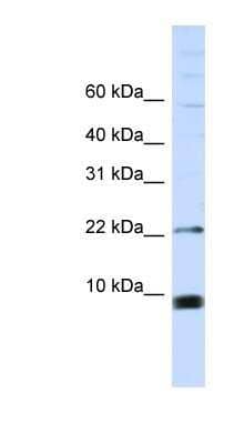 Western Blot: SNRPF Antibody [NBP1-57464]