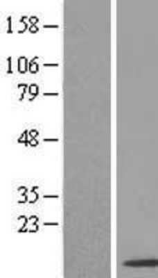 Western Blot: SNRPF Overexpression Lysate [NBL1-16293]