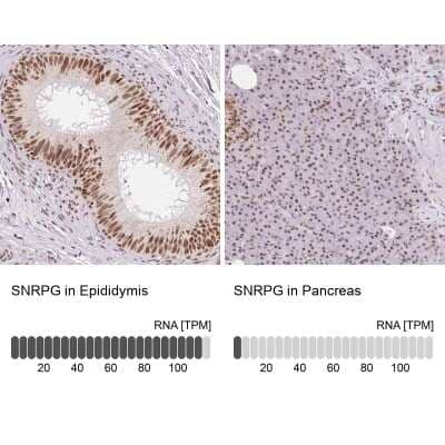 Immunohistochemistry-Paraffin: SNRPG Antibody [NBP2-38045]