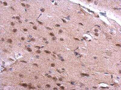 Immunohistochemistry-Paraffin: SNRPN Antibody [NBP2-20439]