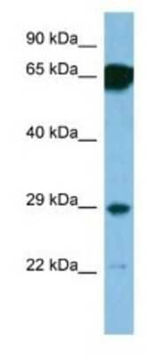 Western Blot: SNRPN Antibody [NBP1-74239]