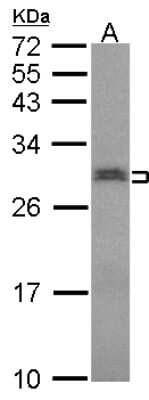Western Blot: SNRPN Antibody [NBP2-20439]