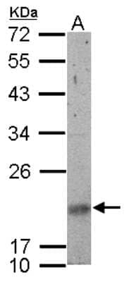 Western Blot: SNRPN Antibody [NBP2-20439]