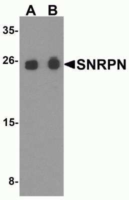 Western Blot: SNRPN AntibodyBSA Free [NBP2-81851]