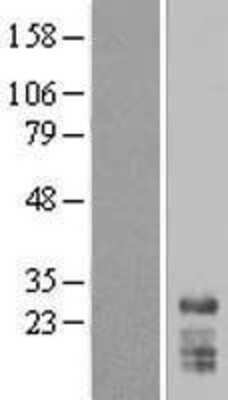 Western Blot: SNRPN Overexpression Lysate [NBL1-16296]