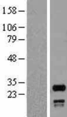 Western Blot: SNRPN Overexpression Lysate [NBP2-09904]