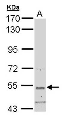 Western Blot: SNTB2 Antibody [NBP1-33009]