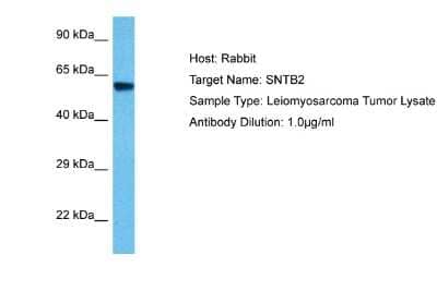 Western Blot: SNTB2 Antibody [NBP2-86816]