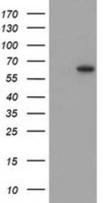 Western Blot: SNTG1 Antibody (OTI3G10) [NBP2-03455]