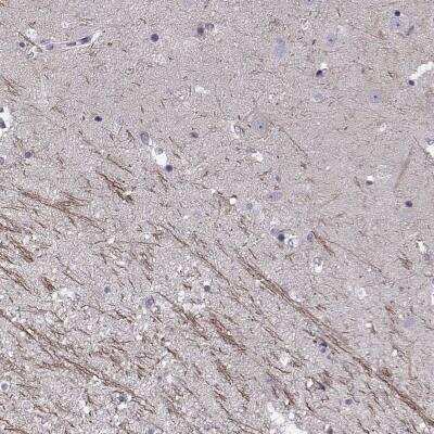 Immunohistochemistry-Paraffin: SNTG1 Antibody [NBP2-56582]