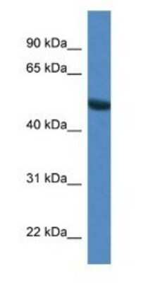 Western Blot: SNTG1 Antibody [NBP1-74119]