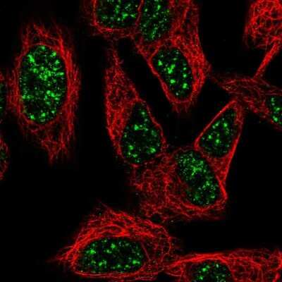 Immunocytochemistry/ Immunofluorescence: SNURF Antibody [NBP2-56044]