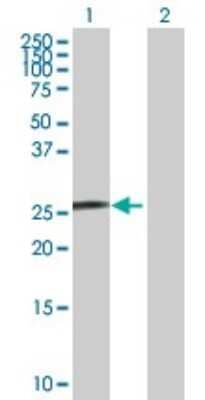 Western Blot: SNURF Antibody [H00008926-B01P]