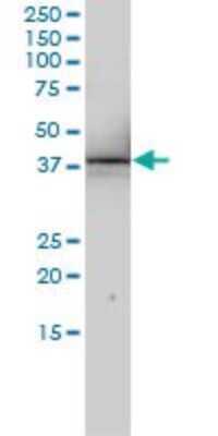 Western Blot: SNURPORTIN1 Antibody (2B2-1B4) [H00010073-M01]