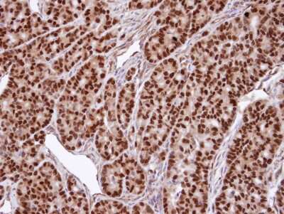 Immunohistochemistry-Paraffin: SNURPORTIN1 Antibody [NBP1-31101]