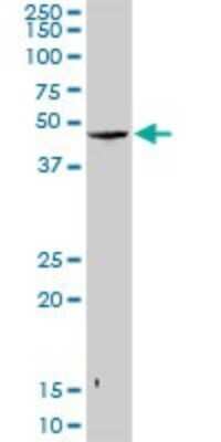 Western Blot: SNURPORTIN1 Antibody [H00010073-D01P]