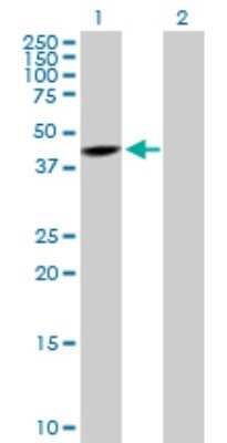 Western Blot: SNURPORTIN1 Antibody [H00010073-D01P]