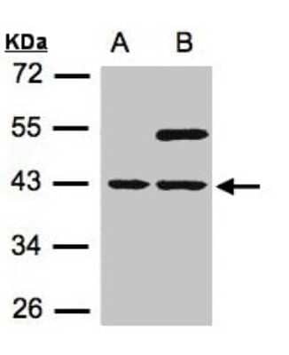 Western Blot: SNURPORTIN1 Antibody [NBP1-31101]