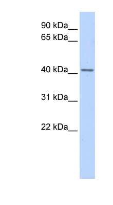 Western Blot: SNURPORTIN1 Antibody [NBP1-57132]