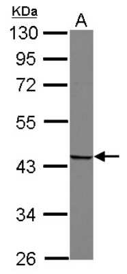 Western Blot: SNURPORTIN1 Antibody [NBP2-19303]