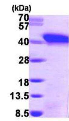 Western Blot: Recombinant Human SNURPORTIN1 His Protein [NBP1-45293]