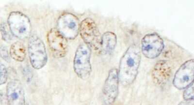 Immunohistochemistry-Paraffin: SNW1 Antibody [NB100-2367]