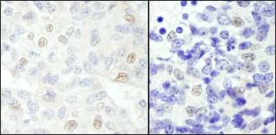 Immunohistochemistry-Paraffin: SNW1 Antibody [NB100-2368]