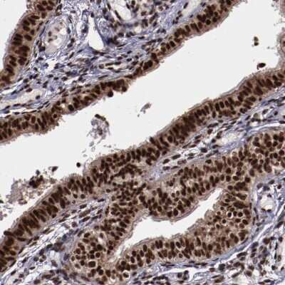 Immunohistochemistry-Paraffin: SNW1 Antibody [NBP1-88523]
