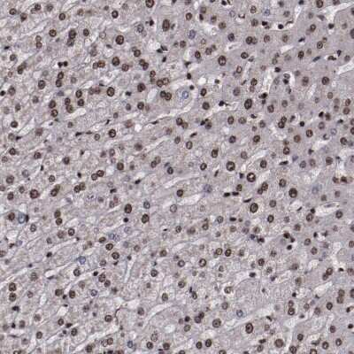 Immunohistochemistry-Paraffin: SNW1 Antibody [NBP1-88523]