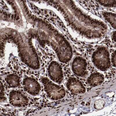 Immunohistochemistry-Paraffin: SNW1 Antibody [NBP1-88523]
