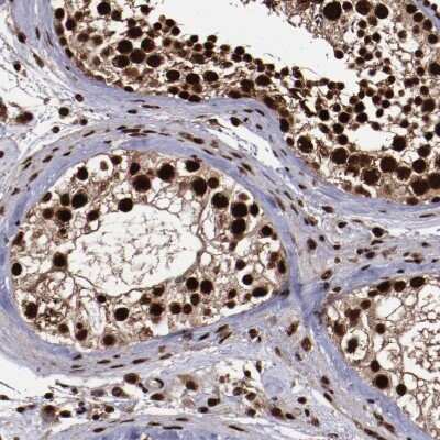 Immunohistochemistry-Paraffin: SNW1 Antibody [NBP1-88523]