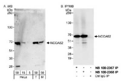 Western Blot: SNW1 Antibody [NB100-2368]