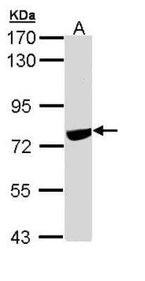 Western Blot: SNW1 Antibody [NBP1-31676]