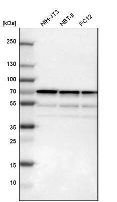 Western Blot: SNW1 Antibody [NBP1-88523]