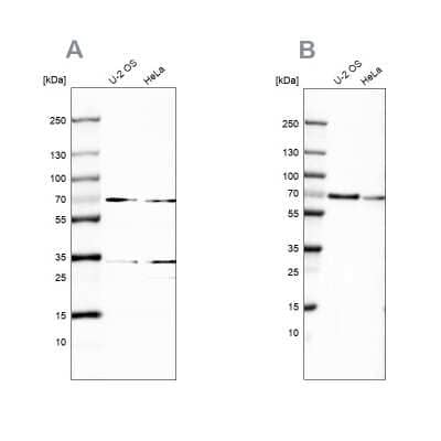 Western Blot: SNW1 Antibody [NBP1-88524]