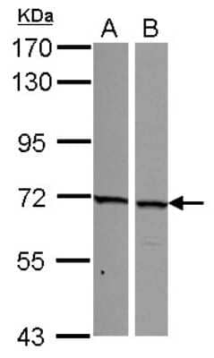 Western Blot: SNW1 Antibody [NBP2-20440]