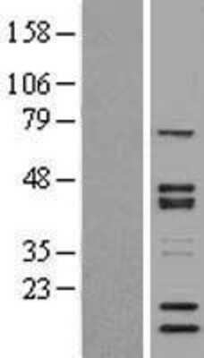 Western Blot: SNW1 Overexpression Lysate [NBP2-04331]