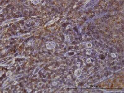 Immunohistochemistry-Paraffin: SNX1 Antibody (6H1) [H00006642-M01]