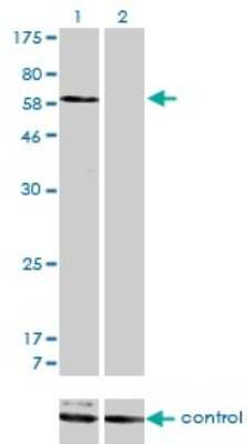 Western Blot: SNX1 Antibody (6H1) [H00006642-M01]