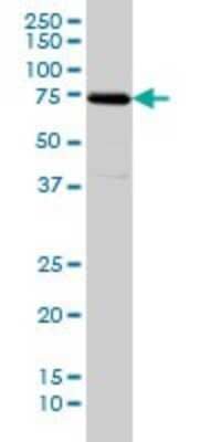 Western Blot: SNX1 Antibody (6H1) [H00006642-M01]