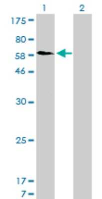 Western Blot: SNX1 Antibody (6H1) [H00006642-M01]