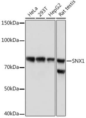 Western Blot: SNX1 Antibody (8G8Z2) [NBP3-16181]